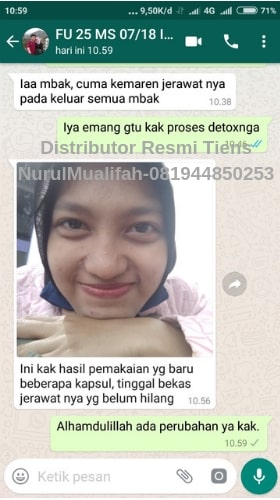 Produk Masker Wajah Tiens