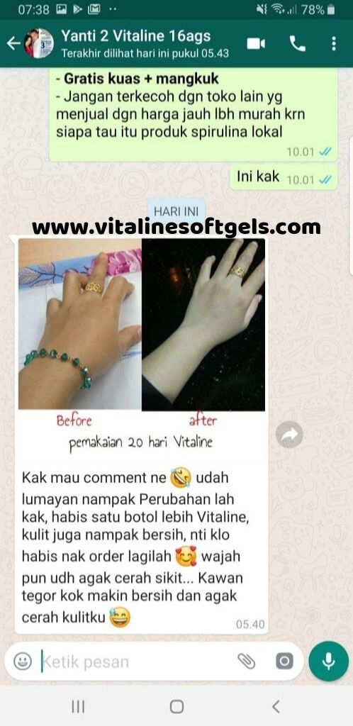 agen vitaline softgels di gresik